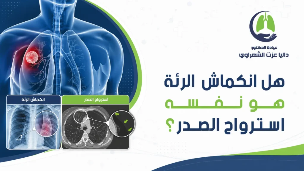 هل انكماش الرئة هو نفسه استرواح الصدر؟
